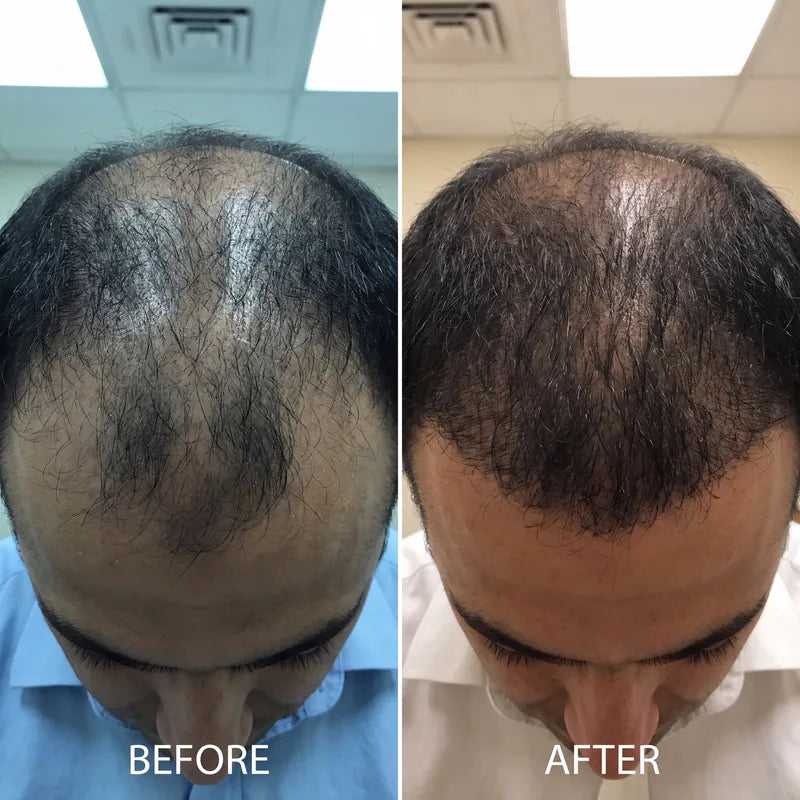 Before and after, fuller looking hair