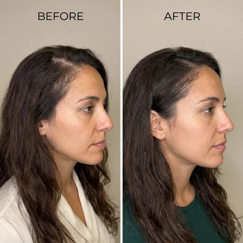 Before and after, fuller looking hair